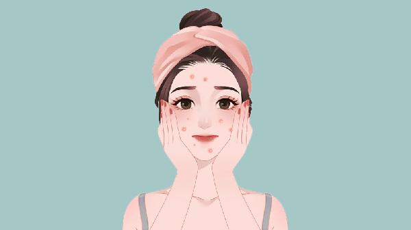 激光祛痘手术的方法是什么?