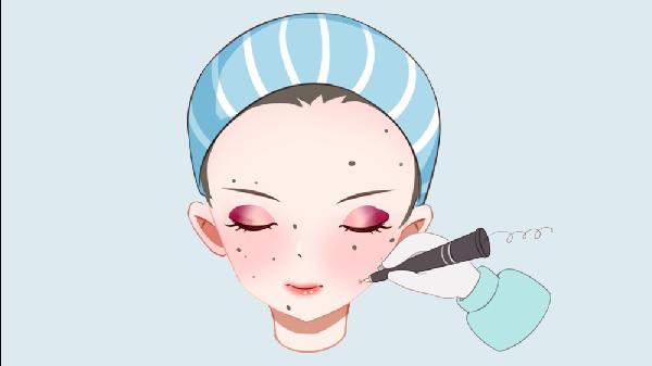 去黑痣失败修复手术需要注意什么?