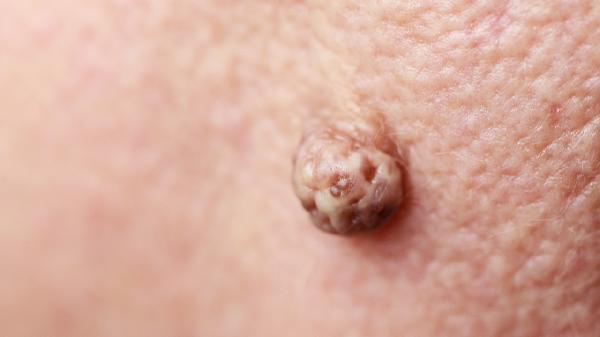 身上皮肤老是痒怎么回事一抓就红