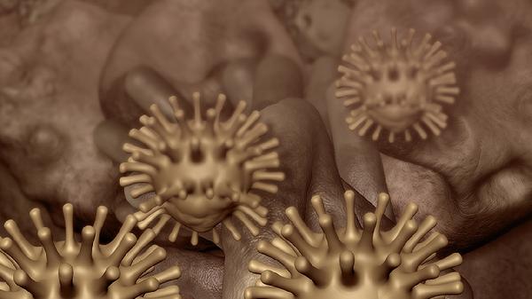 囊肿是什么病严重吗 女性