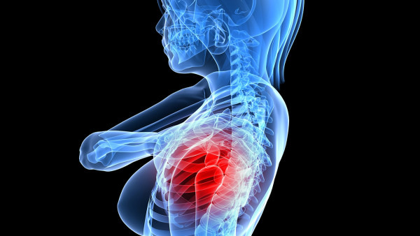 肩周炎用什么药效果最好  肩周炎如何用药才对