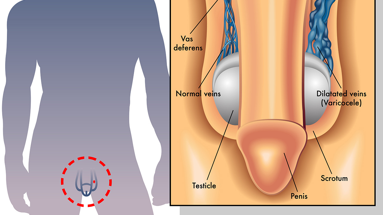 阴茎包皮系带是什么 包皮系带正常怎么样的