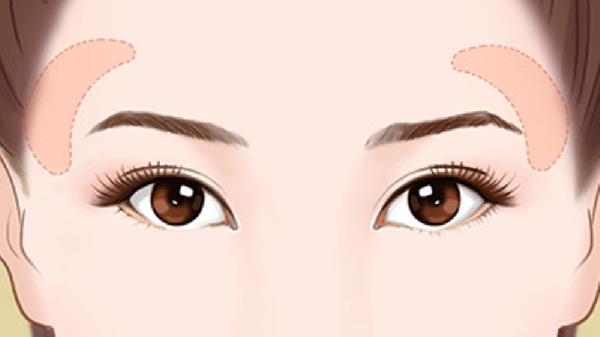 玻尿酸填太阳穴一般用几支