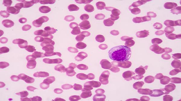 查血能查出心脑血管kaiyun全站网页版登陆吗