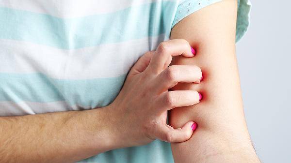 黑色素瘤和痣的区别判断?