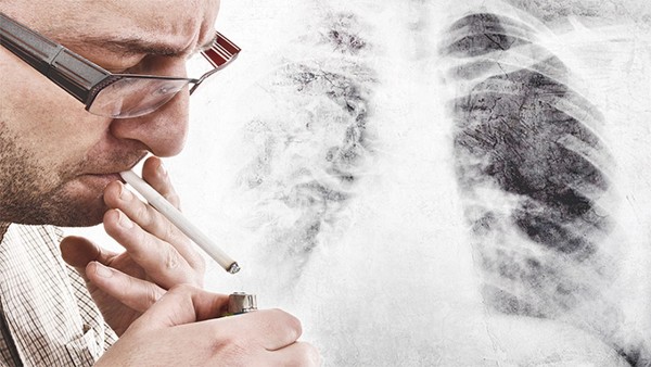 戒烟后发生肺癌的概率是正常人的三倍？警惕肺癌三大危险信号