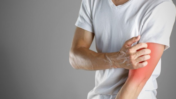 皮肤过敏起红疙瘩该怎么治疗好  过敏吃什么药治疗好