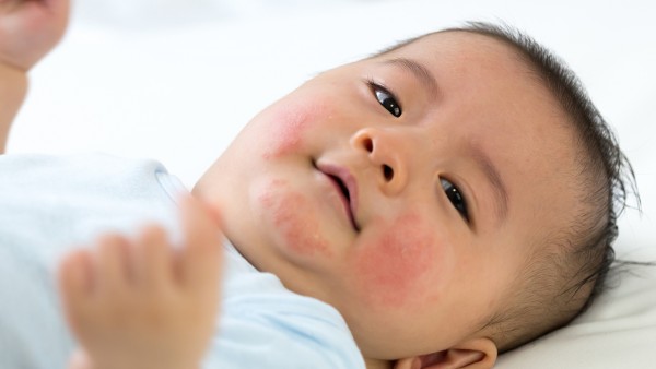 幼儿急疹一般几天能好  幼儿急疹需要吃药吗