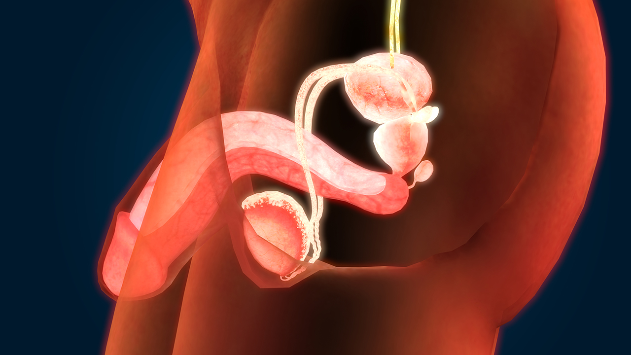 男性前列腺囊肿的原因是什么？