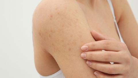 皮肤康洗液依赖性怎么样  皮肤康洗液可以长期使用吗