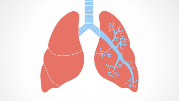 支气管肺炎如何选择药物
