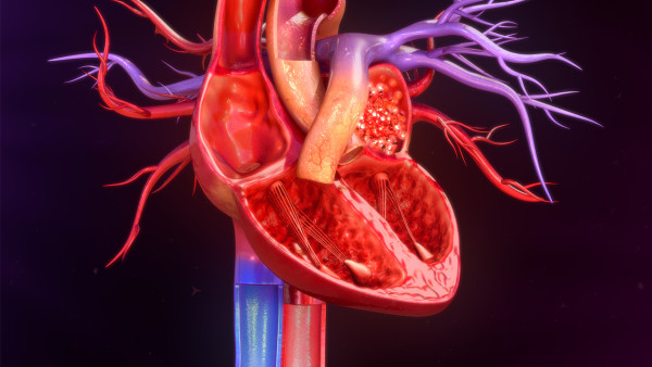 心肌梗死是什么原因导致的 心肌梗死有哪些症状