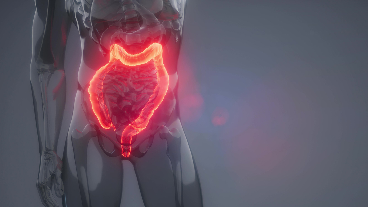 肠胃不好的患者如何预防溃疡性结肠炎？