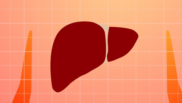 B超显示脂肪肝能否排除肝癌