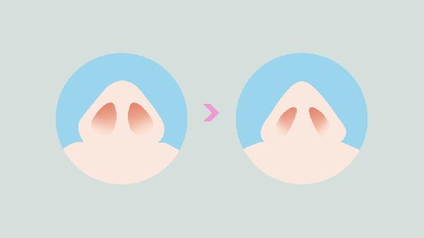 鼻孔整形手术有哪些后遗症？