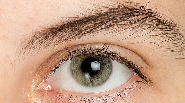 做激光去眼袋什么年龄做比较合适