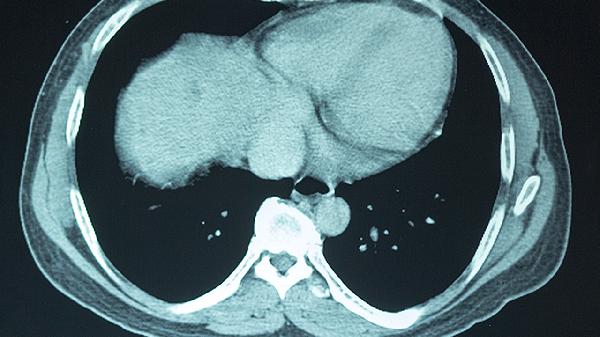 吃什么补充大脑营养提高记忆力效果好