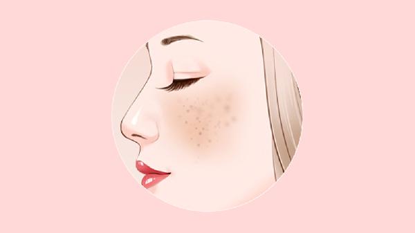 做光子治疗去黄褐斑手术时间是多久？